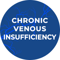 Chronic Venous Insufficiency