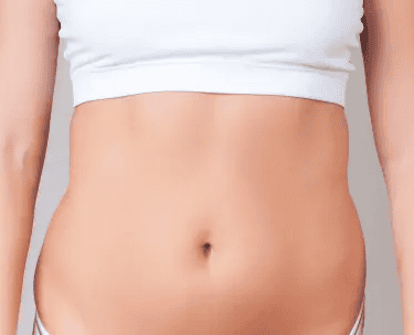 ts-cool-sculpting-after