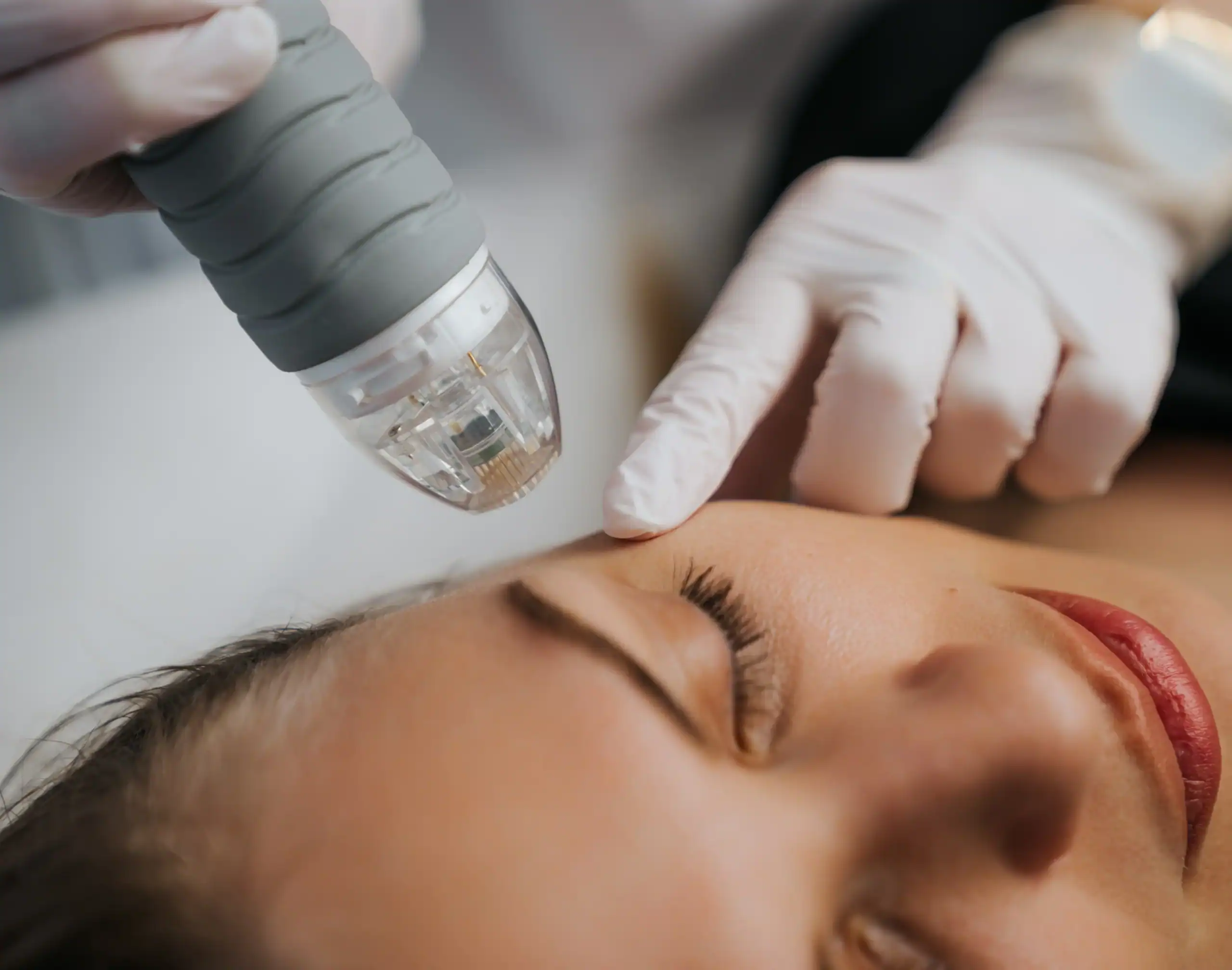 Younger woman gets an aesthetic treatment