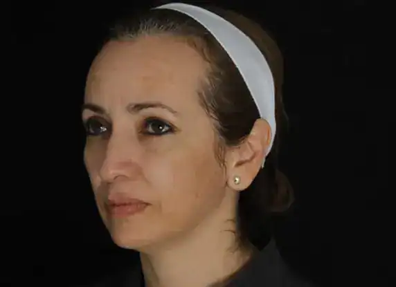 Before Clear + Brilliant treatment, Subject 1